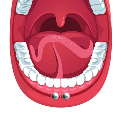 Lip Frenulum Piercing (Frowny Piercing)